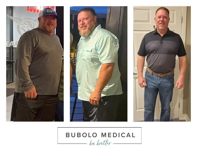 Andrew's weight loss transformation at Bubolo Medical in Acworth, GA — before and after photos