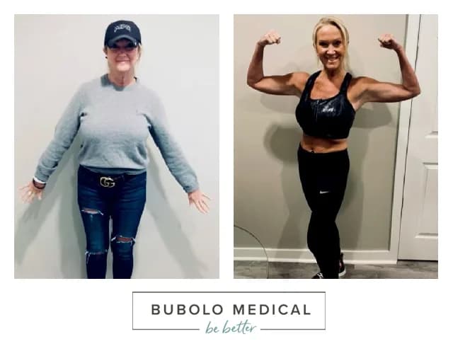 Barbie's weight loss transformation at Bubolo Medical in Acworth, GA — before and after photos